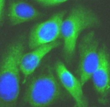 MAP2K6 Antibody