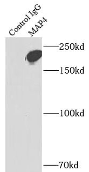 MAP4 Rabbit Polyclonal Antibody