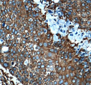 MAP4 Rabbit Polyclonal Antibody