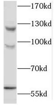 MAP4K5 Rabbit Polyclonal Antibody