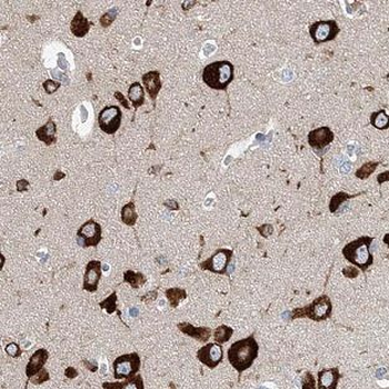 MAPK11 Rabbit Polyclonal Antibody