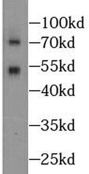 MAPKAPK2 Rabbit Polyclonal Antibody