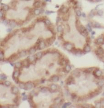 MAPKAPK2 Rabbit Polyclonal Antibody