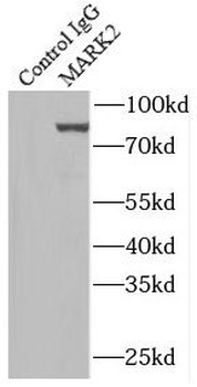 MARK2 Rabbit Polyclonal Antibody