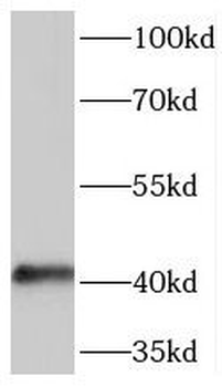 SERPINB5 Rabbit Polyclonal Antibody