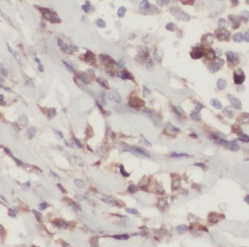 SERPINB5 Rabbit Polyclonal Antibody