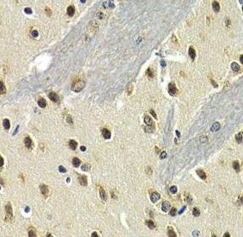 MAX Rabbit Polyclonal Antibody