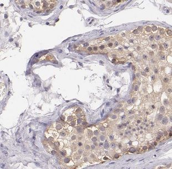 MBIP Rabbit Polyclonal Antibody