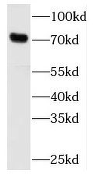 MCCC1 Antibody