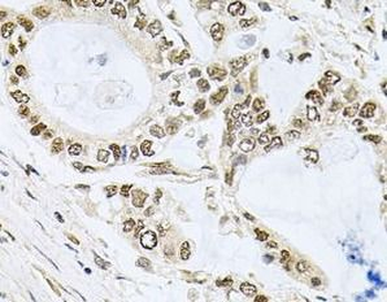 MCL1 Rabbit Polyclonal Antibody