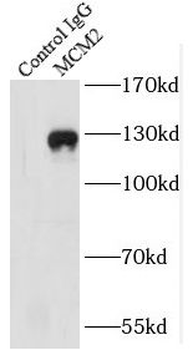 MCM2 Rabbit Polyclonal Antibody