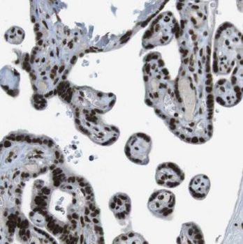 MCM2 Rabbit Polyclonal Antibody