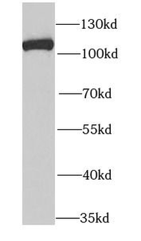 MCM3 Rabbit Polyclonal Antibody