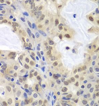 MCM3 Rabbit Polyclonal Antibody