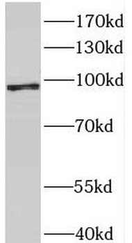 MCM8 Antibody