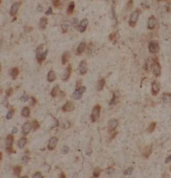 MCTP2 Rabbit Polyclonal Antibody