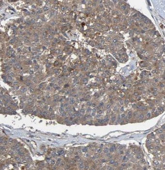 MEA1 Rabbit Polyclonal Antibody