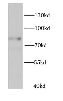 MECP2 Rabbit Polyclonal Antibody