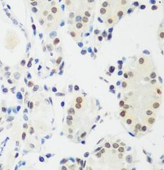 MECP2 Rabbit Polyclonal Antibody