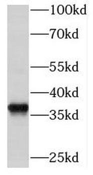 MECR Antibody