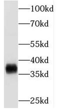 MECR Antibody