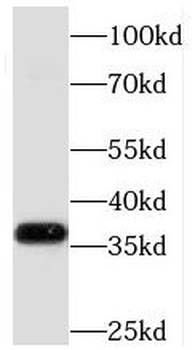 MECR Antibody