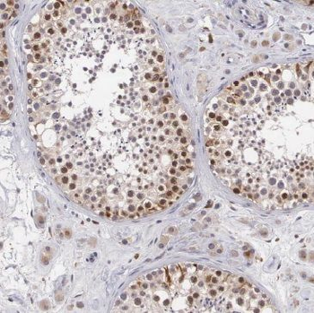 MED19 Rabbit Polyclonal Antibody