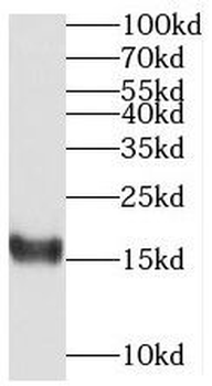 MED31 Antibody