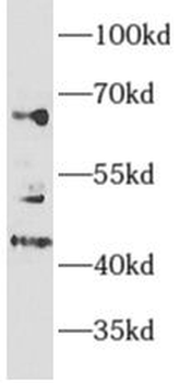 MEF2C Rabbit Polyclonal Antibody