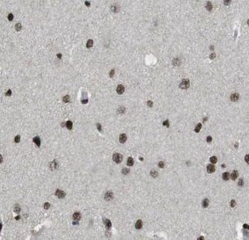 MEF2C Rabbit Polyclonal Antibody