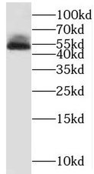 MEF2C Rabbit Polyclonal Antibody