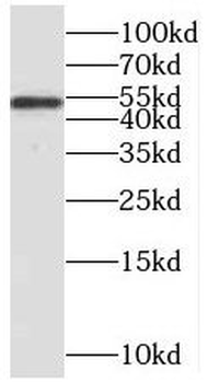 MEF2C Rabbit Polyclonal Antibody
