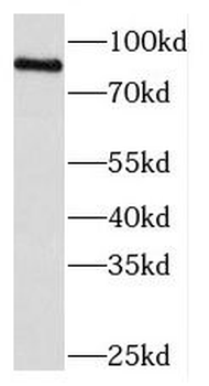 MEFV Antibody