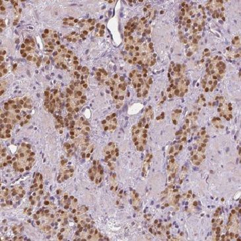 MEIS2 Rabbit Polyclonal Antibody