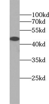 MAP2K2 Antibody