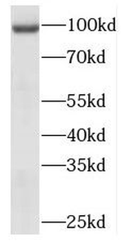 MEPE Antibody