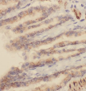 MEPE Rabbit Polyclonal Antibody