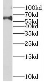 METTL16 Antibody