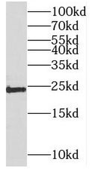 METTL5 Rabbit Polyclonal Antibody