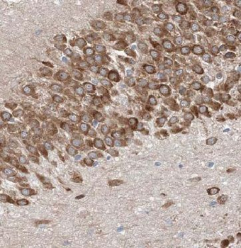 METTL5 Rabbit Polyclonal Antibody