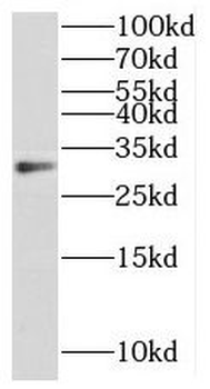 METTL6 Antibody