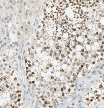 METTL6 Rabbit Polyclonal Antibody