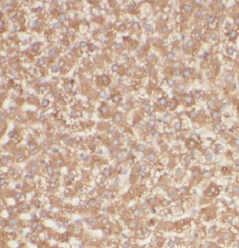 TMT1B Rabbit Polyclonal Antibody