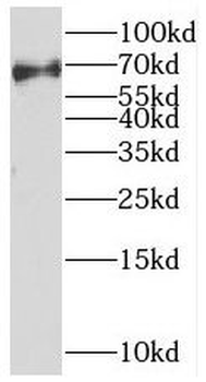 MEX3C Antibody