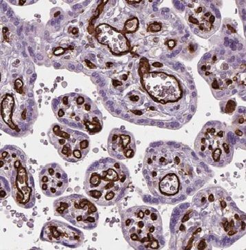 MFAP5 Rabbit Polyclonal Antibody