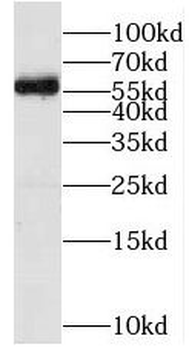 MFSD8 Antibody