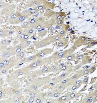 MGAT1 Rabbit Polyclonal Antibody
