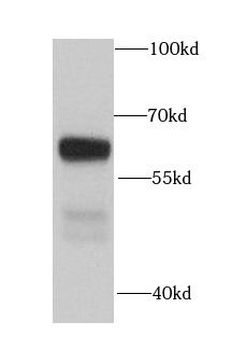 MGAT3 Rabbit Polyclonal Antibody