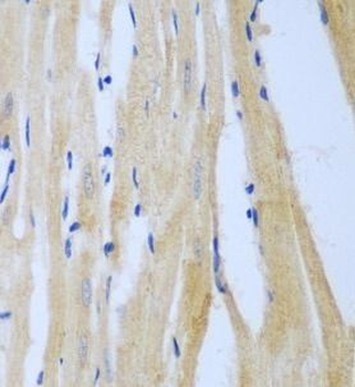 MGAT3 Rabbit Polyclonal Antibody