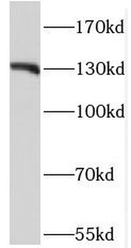 OGA Antibody